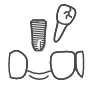 Icon of a tooth being removed and replaced with a dental implant