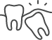 Icon of an impacted tooth pressing against the adjacent tooth