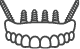 Icon of an implant denture with the two back implants at a diagonal angle