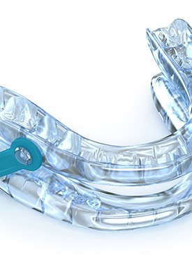 A sleep apnea appliance near Winchester