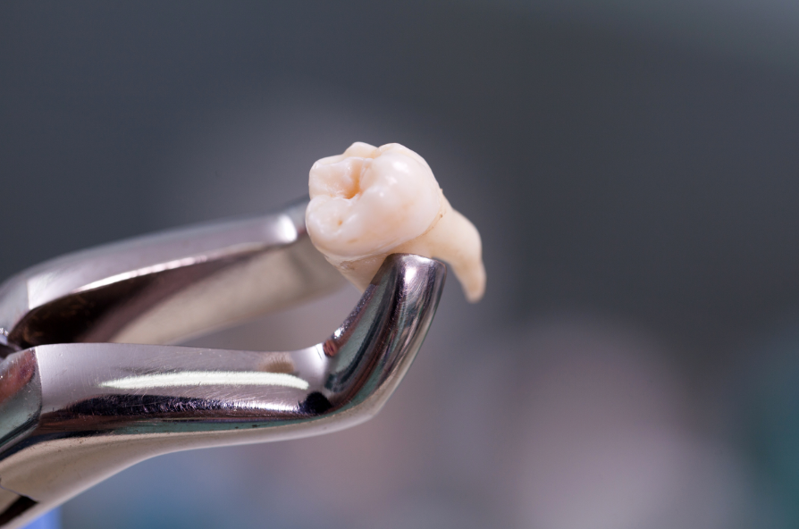 Tooth on forceps
